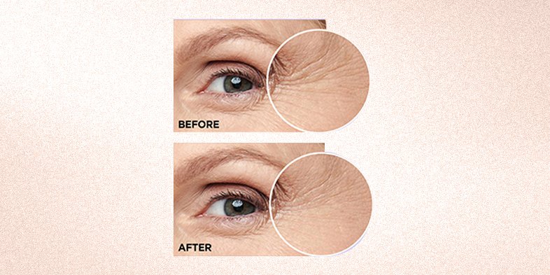 In-Article-best-anti-aging-skin-care-products_1